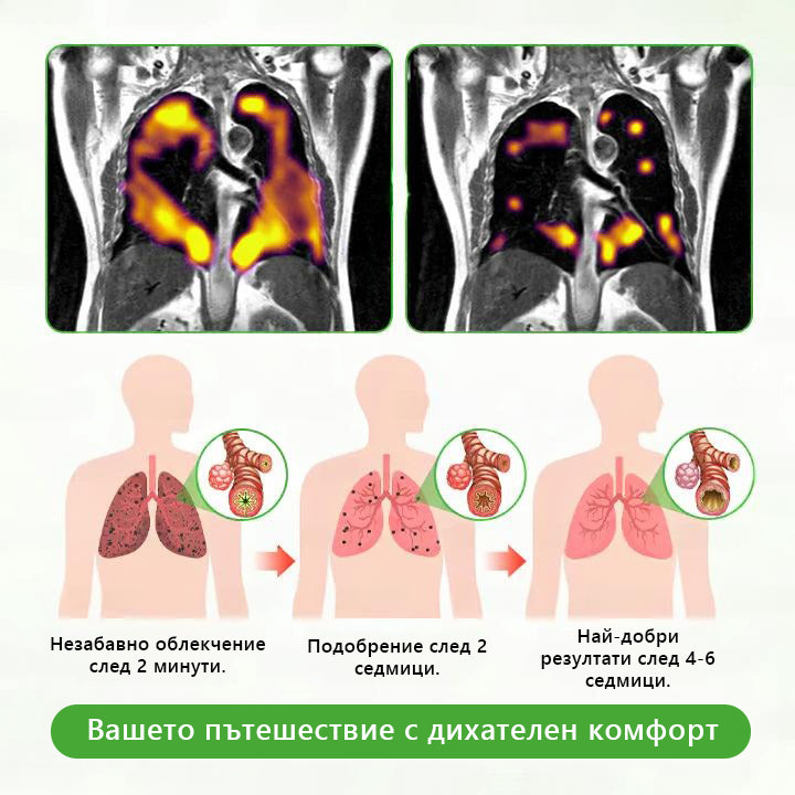 Българска собственост и управление ✅ Murwon® билков дифузер за прочистване на белите дробове с лопен (Mullein)  (🫁 кашлица, фарингит, задух, храчки, запушен нос, бронхит, бронхит, алергични симптоми, дискомфорт в белите дробове) 🌷