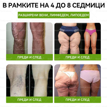 Официален магазин |  🥇👩‍⚕️Geleemon® Glumasetide 8 в 1 нано микроиглена лепенка – само веднъж дневно ✅ Видими промени за 7 дни при затлъстяване, отпусната кожа и здраве