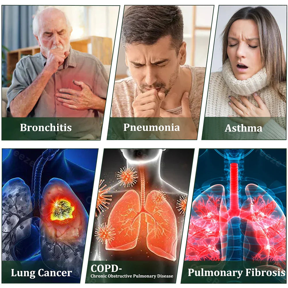 🇺🇸 𝐏𝐫𝐨𝐮𝐝𝐥𝐲 𝐌𝐚𝐝𝐞 & 𝐒𝐡𝐢𝐩𝐩𝐞𝐝 𝐢𝐧 𝐭𝐡𝐞 𝐔𝐒A✅𝐌𝐮𝐫𝐰𝒐𝒏® 𝐁𝐨𝐭𝐚𝐧𝐢𝐜𝐚𝐥 𝐌𝐮𝐥𝐥𝐞𝐢𝐧 𝐋𝐮𝐧𝐠 𝐂𝐥𝐞𝐚𝐧𝐬𝐞 𝐃𝐢𝐟𝐟𝐮𝐬𝐞𝐫🔥(👨‍⚕️Cough, Pharyngitis, shortness of breath, sputum, stuffy nose, bronchitis, bronchitis, allergy symptoms, lung discomfort)3❤️
